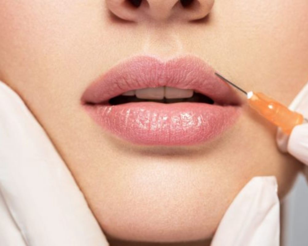 lip-injection-in-bellevue